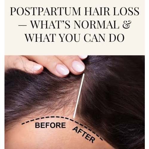 POSTPARTUM SCALP SERUM | Happy Hive