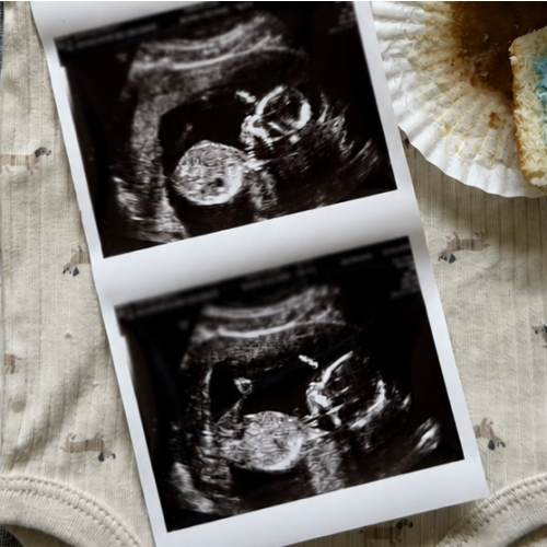 Newborn Photo Shoot