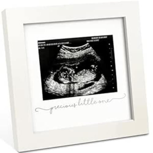 KeaBabies Baby Sonogram Picture Frame - Modern Ultrasound Picture Frames for Mom to Be, First Pregnancy Gifts for Expecting Mom & First Time Dad, Baby Gender Reveal Gifts (Alpine White)