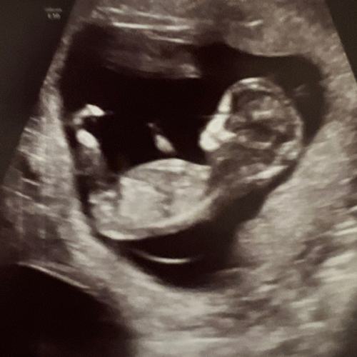 Cash Fund for Baby Sy