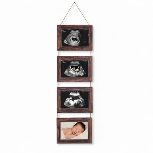 4-in-1 Sonogram Picture Frame, Display Pregnancy Keepsake Album for Pregnancy Announcements, Gender Reveal and Newborn Photos, Perfect Nursery Decor, First Time Mom Gifts, Brown