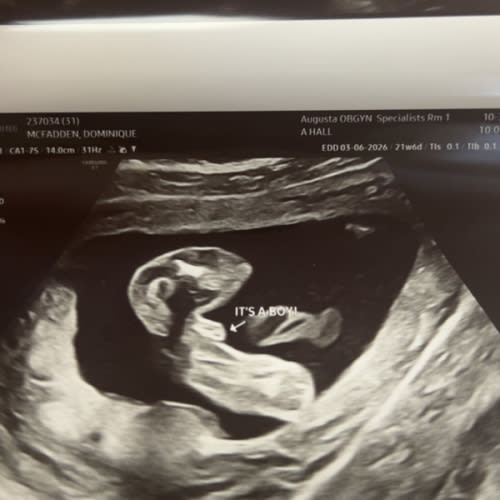 Amazon: Baby Registry