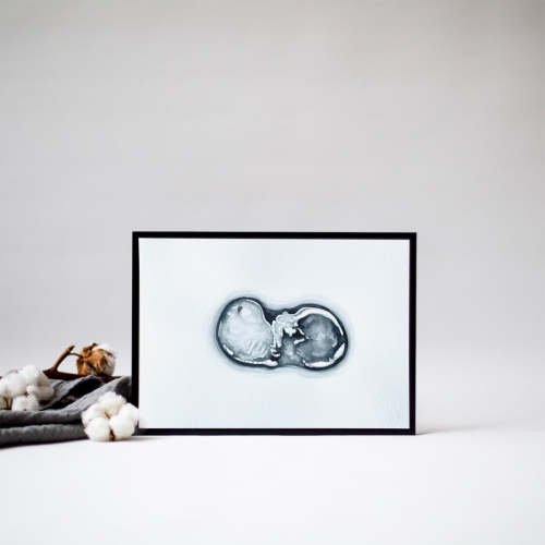 Ultrasound Art