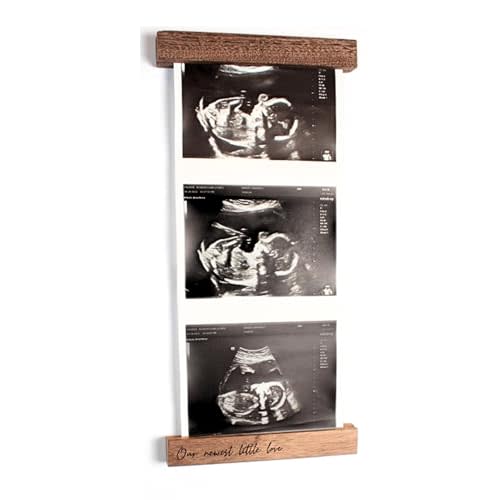 Oscar Bee Sonogram Photo Frame | Ultrasound Keepsake for Baby | Ideal Pregnancy Announcement | Magnetic Picture Frame for Refrigerator | Walnut Finish | Ultrasound Picture Frame | Baby Reveal Gift
