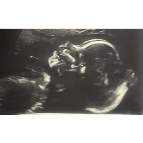 Baby's Future Fund