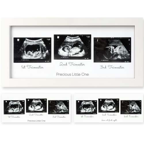 Baby Sonogram Frame 3-Trimester Ultrasound | KeaBabies