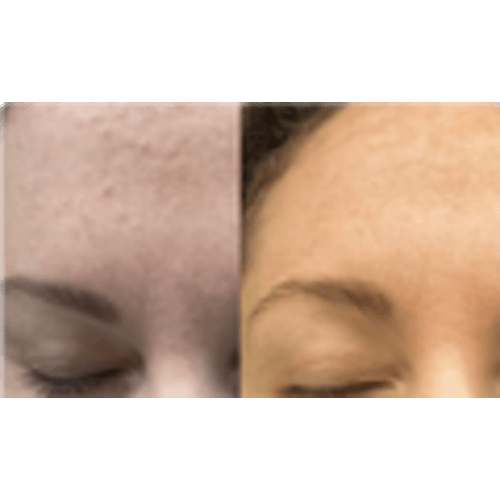 The Complete System for Mature Women’s Skin | Frøya Organics