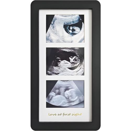 Love at First Sight Ultrasound Picture Frames,Triple Ultrasound Picture Frames,Sonogram Picture Frame 3 Photos,Pregnancy Announcements (Black)