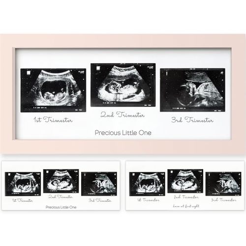 KeaBabies Baby Sonogram Picture Frames,Trio Ultrasound Photo (Petal Pink)