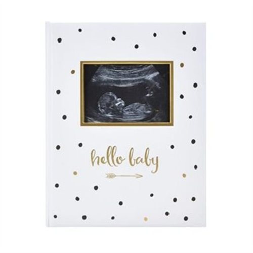 PEARHEAD BABYBOOK, SONO by Pearhead | Memory Books & Photo Albums Gifts | www.chapters.indigo.ca