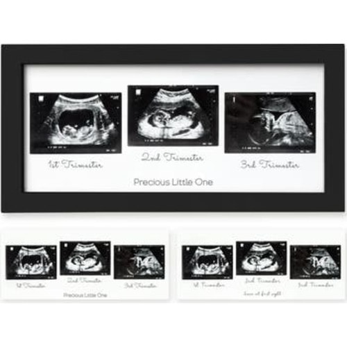 Trio Baby Sonogram Frame
