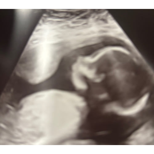 Add the Babylist Button