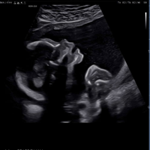 Luca’s fund 💙👶🏻