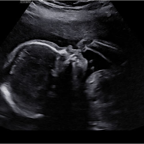 Baby Paat’s Thrifty Fund