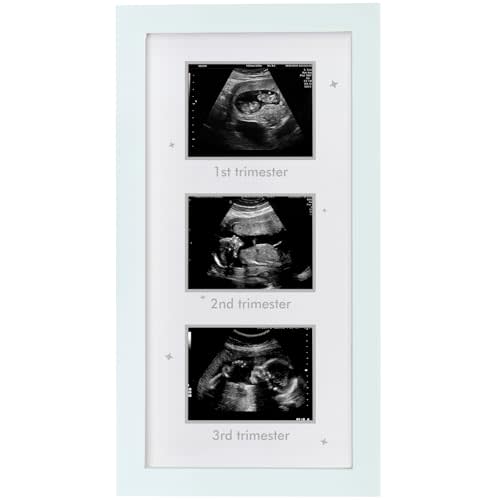 HAMUIERS Ultrasound Picture Frame - Triple Sonogram Frame for Mom to Be | Pregnancy Photo Album Decor | Baby Nursery Essentials & Gender Reveal Gifts | First Trimester Keepsake & Pregnancy Must Haves - White2