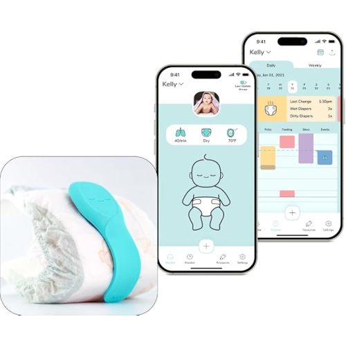 Aurio Smart Baby Monitor – Tracks Breathing Rate, Sleep, Diaper Wetness, Temperature, Real-Time Alerts with Patented Technology