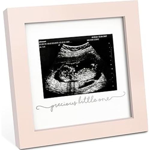 KeaBabies Baby Sonogram Picture Frame - Modern Ultrasound Picture Frames for Mom to Be, First Pregnancy Gifts for Expecting Mom & First Time Dad, Baby Gender Reveal Gifts (Petal Pink)
