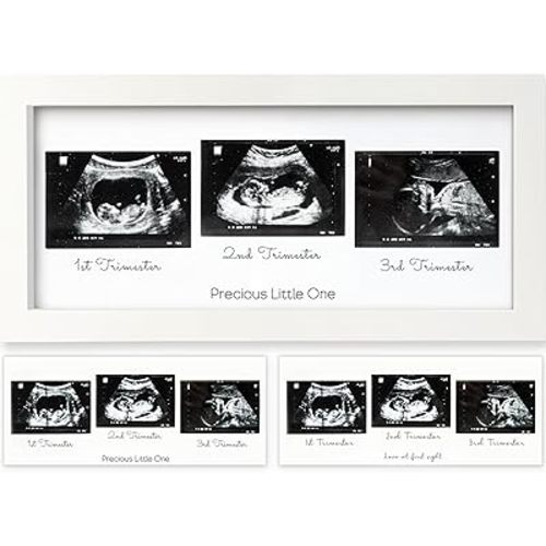 KeaBabies Baby Sonogram Picture Frames - Trio Ultrasound Picture Frames, First Time Mom Gift, Cute Pregnancy Reveal Photo Frame, Baby Gender Reveal Gift, Newborn Nursery Decor (Alpine White)
