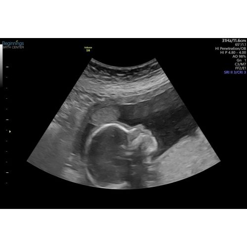 Homebirth fund