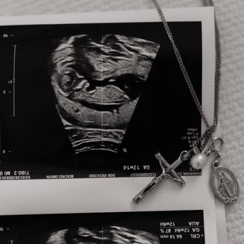 Midwife/doula Fund
