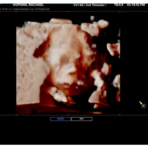 Teacher Parents of a Summer Newborn Fund