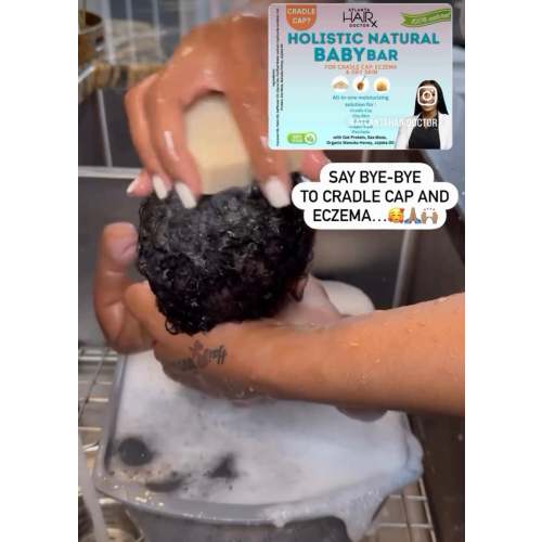 HOLISTIC NATURAL BABY BAR (Cradle Cap Treatment for Babies, Soothes Babies Scalp, Prevents Dryness and Flakes)