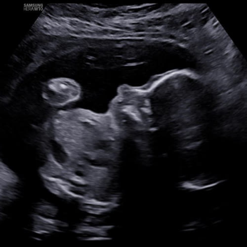 Babylist Parental Leave Fund