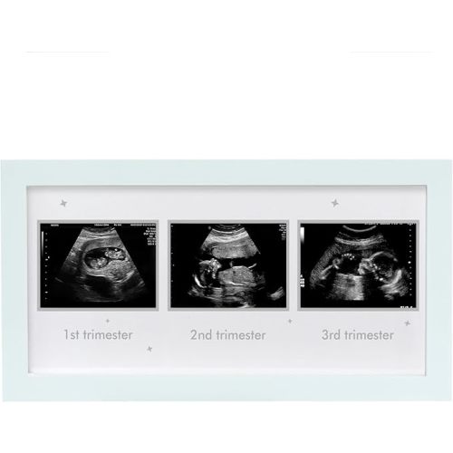 HAMUIERS Ultrasound Picture Frame - Triple Sonogram Frame for Mom to Be | Pregnancy Photo Album Decor | Baby Nursery Essentials & Gender Reveal Gifts | First Trimester Keepsake & Pregnancy Must Haves - White1