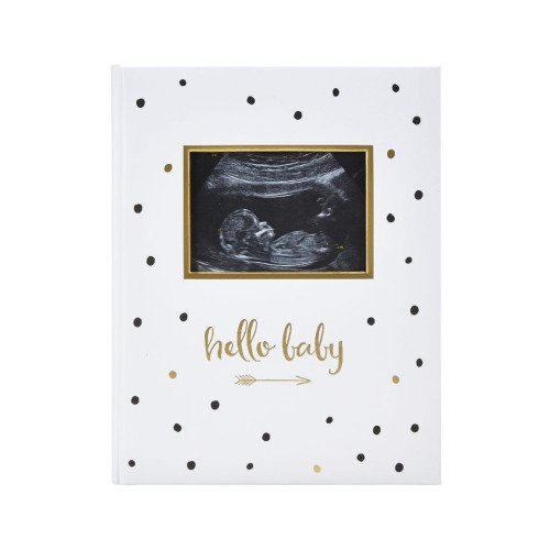 Pearhead Black, White and Gold Baby Memory Book