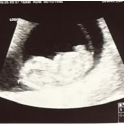 Baby Soltan Fund