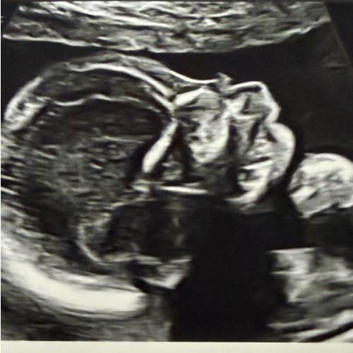 Casey and Tanner Schmidt’s Baby Registry at Babylist
