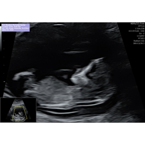 Lindsey White and Carlos P’s Baby Registry at Babylist