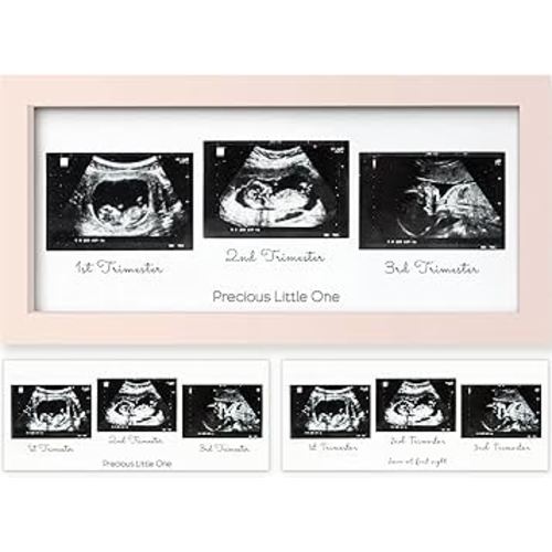 KeaBabies Baby Sonogram Picture Frames - Trio Ultrasound Picture Frames, First Time Mom Gift, Cute Pregnancy Reveal Photo Frame, Baby Gender Reveal Gift, Newborn Nursery Decor (Petal Pink)