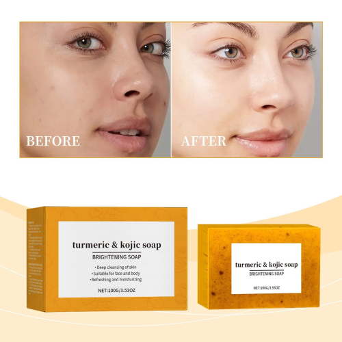 Turmeric Soap Bar for Face & Body - Acne, Dark Spots, Smooth Skin, Natural Handmade Soap for All Skin Types for Men and Women