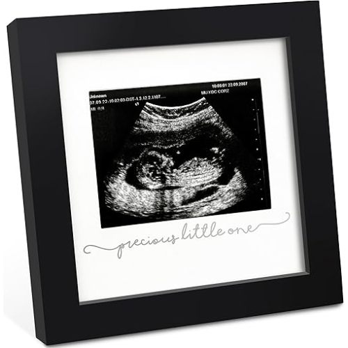 KeaBabies Baby Sonogram Picture Frame - Modern Ultrasound Frame for Mom to Be - Pregnancy Announcement Sonogram Photo Frames - Gender Reveal for Expecting Parents - First Time Dad Gifts (Onyx Black)