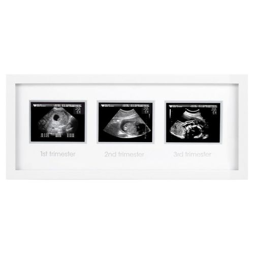 Pearhead Trimester Sonogram Frame - White