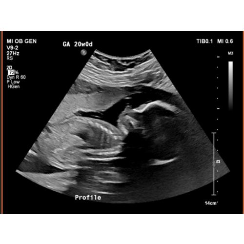 Baby Extras Fund