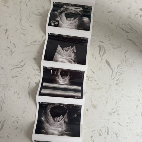 Baby Fund