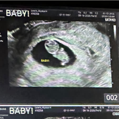 Hope Lewis and Carter Loney’s Baby Registry at Babylist