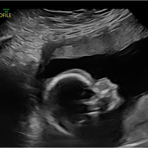 Brants Maternity Leave Fund 💓