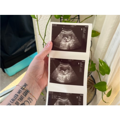 Maternity Leave Fund