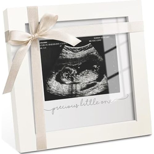KeaBabies Baby Sonogram Picture Frame, Ultrasound Photo Frame, Alpine White