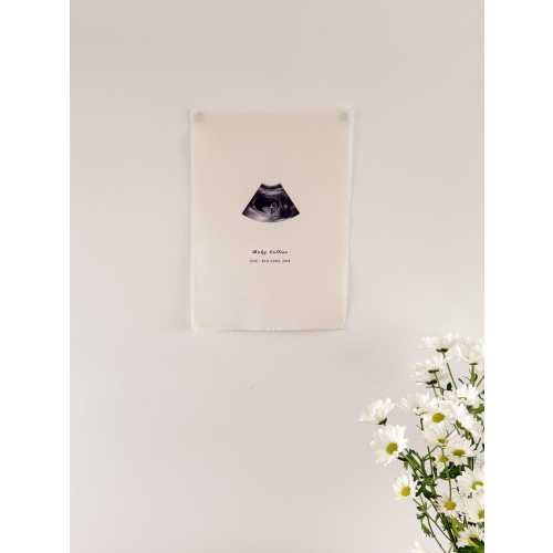 Custom Baby Ultrasound Tapestry: Organic Cotton Keepsake, Nursery Decor