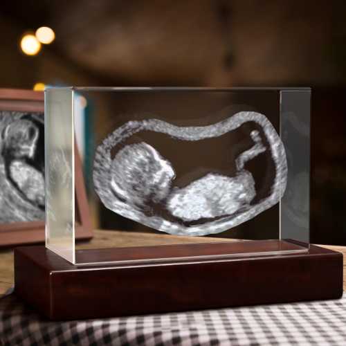Expecting Parents Gift, Custom Baby Ultrasound Crystal, Baby Shower Present, Mother's Day, Mom Gift Idea | BridgensLaser 3D Photo Crystal