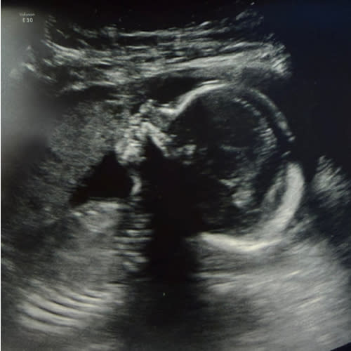 Amazon Baby Registry