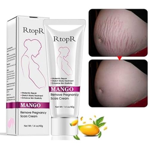 Mango Stretch Marks and Scar Cream, Stretch Mark and Scar Removal Cream for Pregnancy, Belly Creams for Wrinkles, Obesity Fat Marks Scars Moisturizing, Remove Marks (40g)