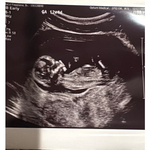 Beth’s Postpartum Meals