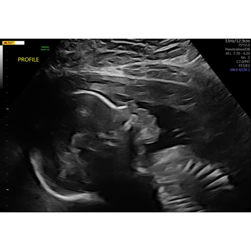 Schedule 3D/4D Ultrasounds Online in MN | Enlightened 4D