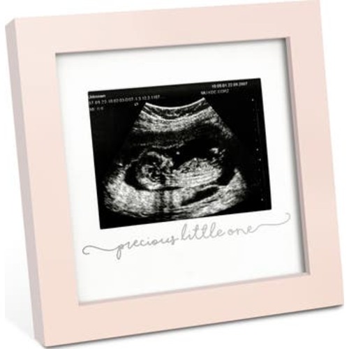 Solo Baby Sonogram Frame
