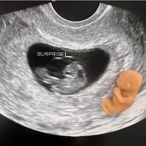 Baby Fund